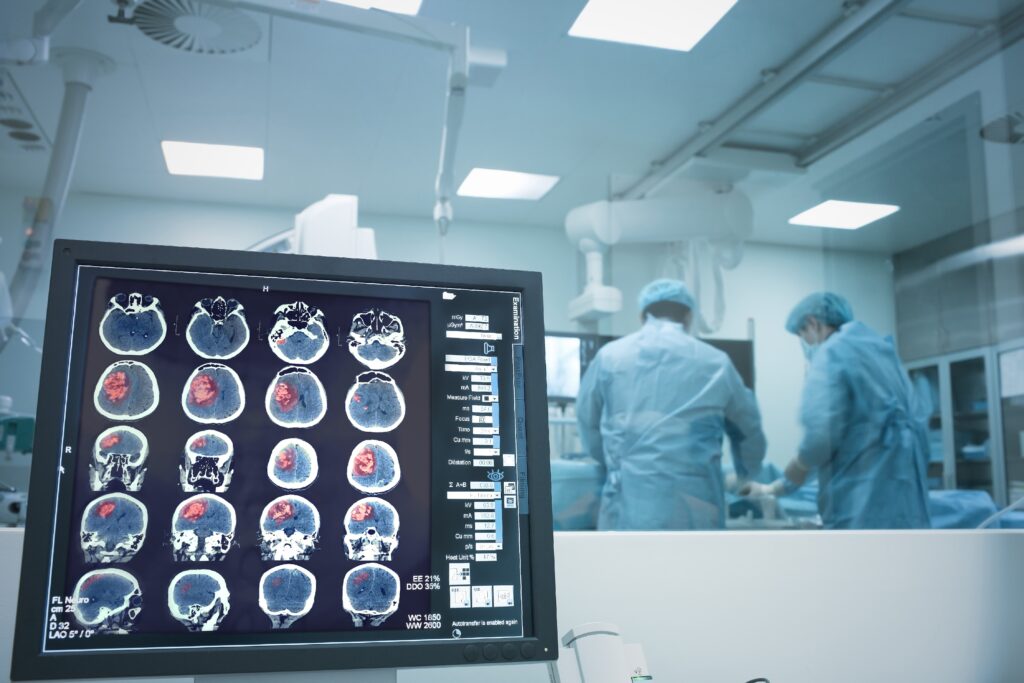 Yozgat Şehir Hastanesi Beyin ve Sinir Cerrahi Doktorları