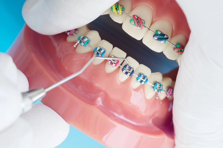 Ankara Tepebaşı Ağız ve Diş Sağlığı Hastanesi Diş Doktorları