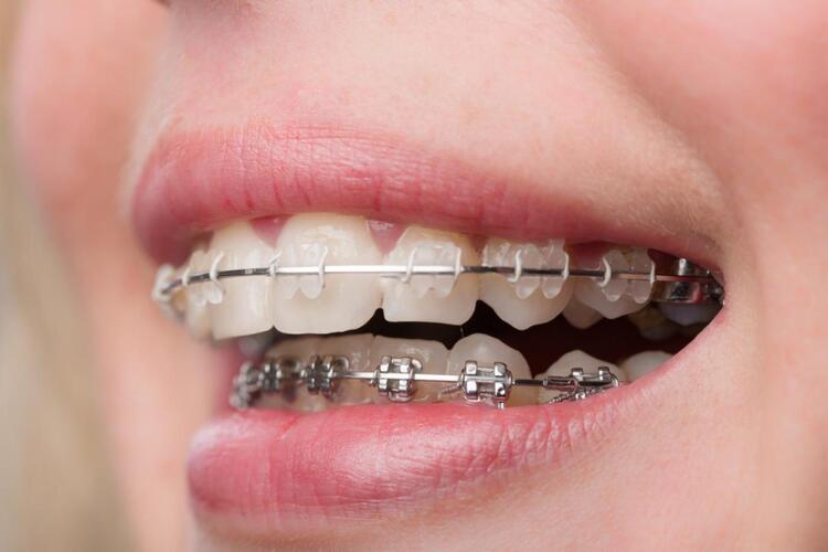 Antalya Ağız ve Diş Sağlığı Hastanesi Diş Doktorları