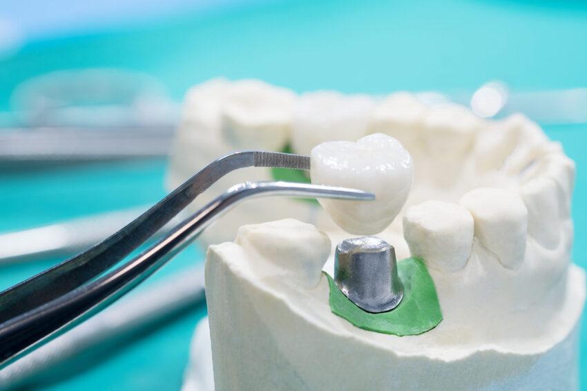 Konya Ağız ve Diş Sağlığı Hastanesi Diş Doktorları