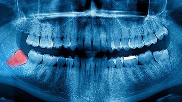 Şanlıurfa Ağız ve Diş Sağlığı Hastanesi Diş Doktorları