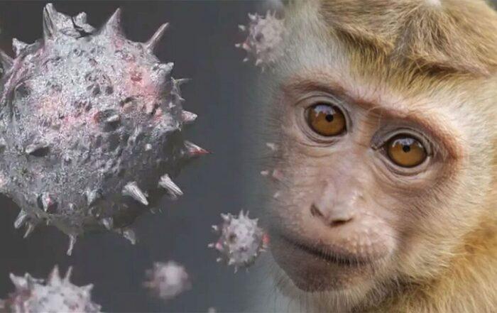 Maymun Çiçeği Virüsü
