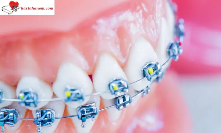 Hatay İskenderun Ağız ve Diş Sağlığı Merkezi Diş Doktorları
