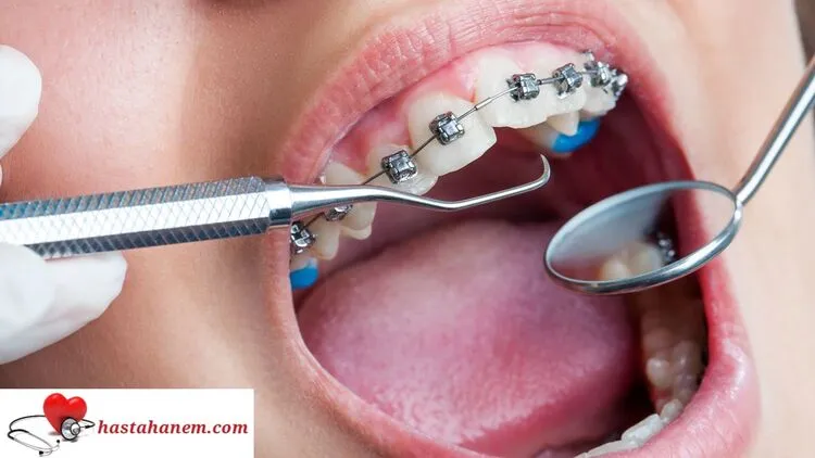 Isparta Ağız ve Diş Sağlığı Merkezi Diş Doktorları