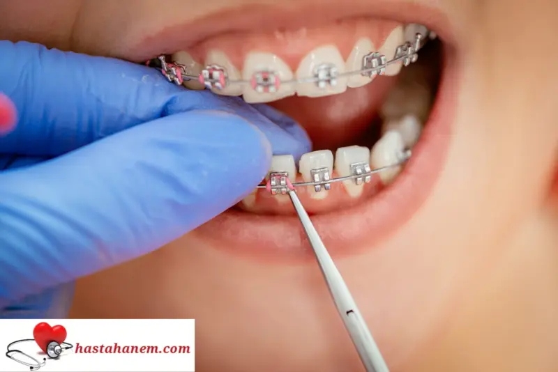 Ankara Etimesgut Ağız ve Diş Sağlığı Merkezi Diş Doktorları