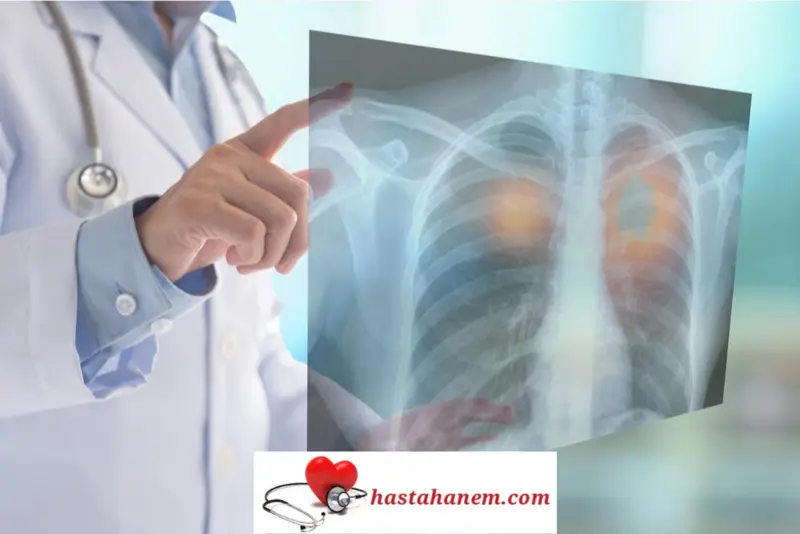İstanbul Haydarpaşa Numune Eğitim ve Araştırma Hastanesi Göğüs Hastalıkları Doktorları