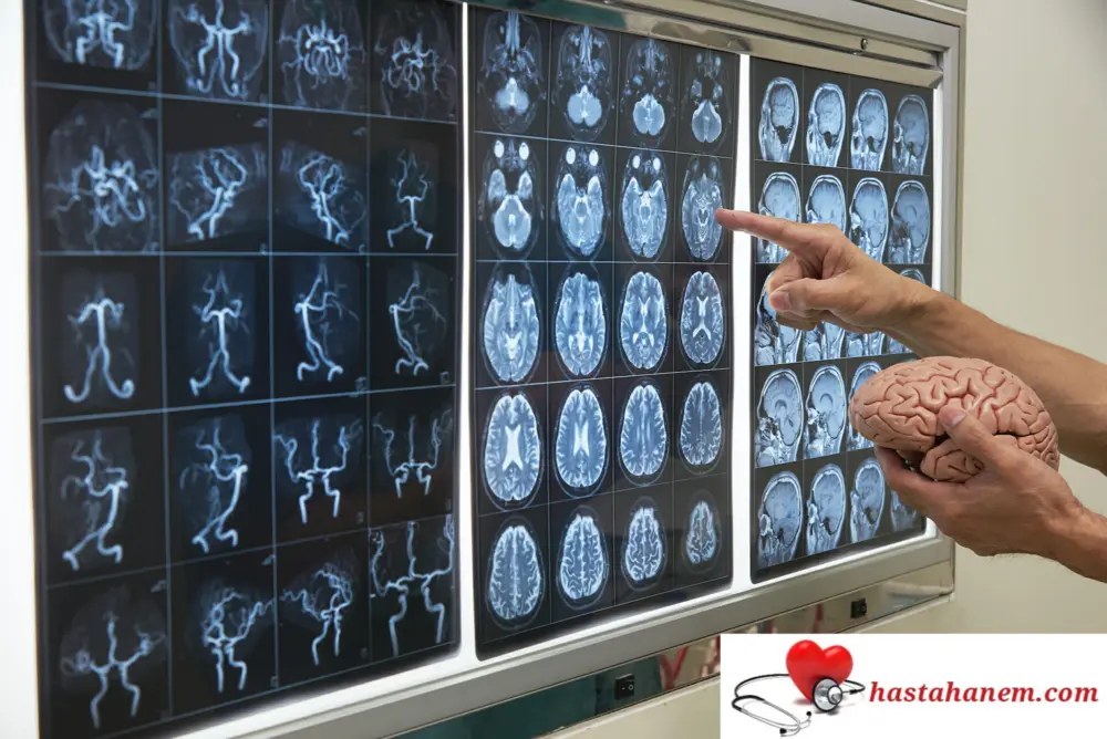 Mersin Toros Devlet Hastanesi Beyin ve Sinir Cerrahisi Doktorları
