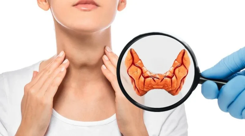Tiroid Bezi Nedir? Zehirli Tiroid Belirtileri ve Tedavisi