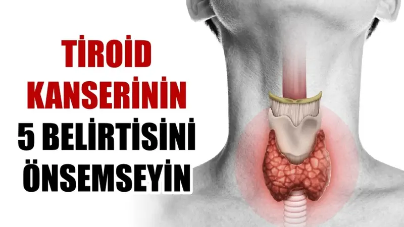 Tiroid Kanseri Belirtileri ve Tedavisi